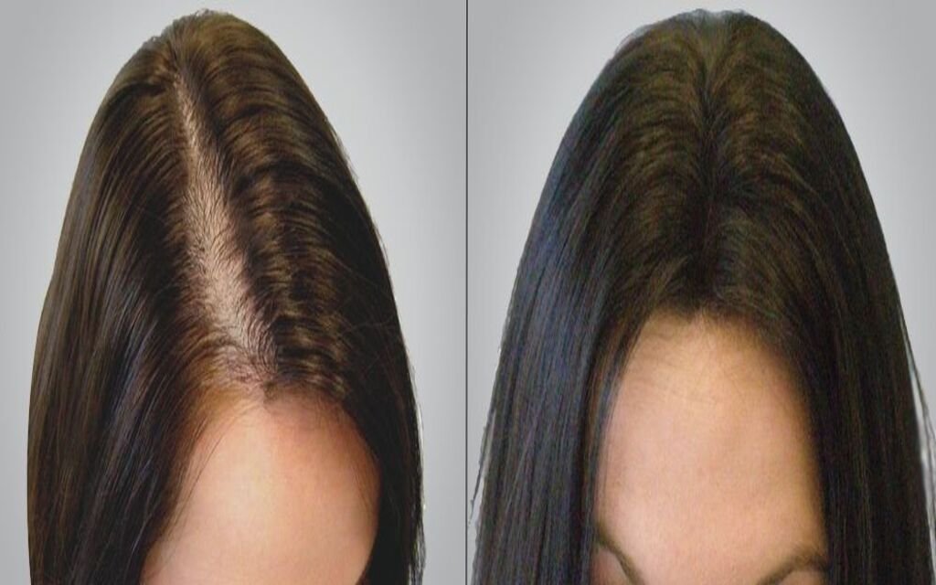 How does Redensyl Work for Hair Growth?