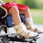 Cerebral Palsy Causes & Treatment