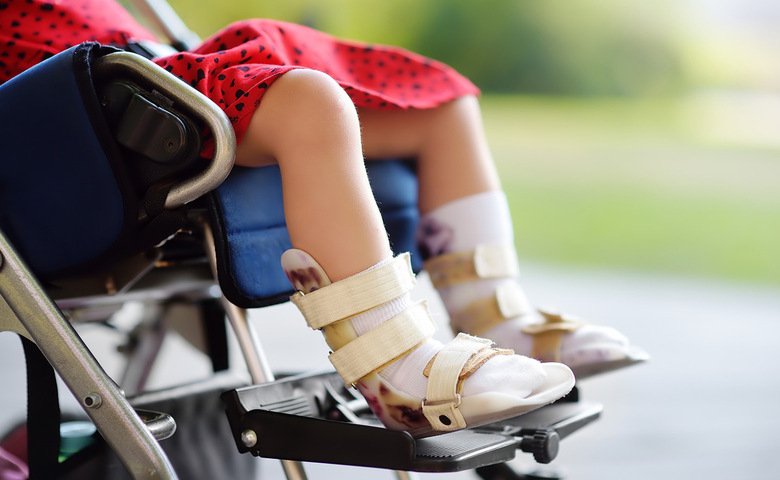 Cerebral Palsy Causes & Treatment