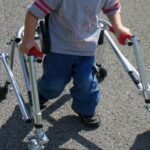 Cerebral Palsy Compensation Claims